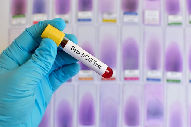 Beta hCG test