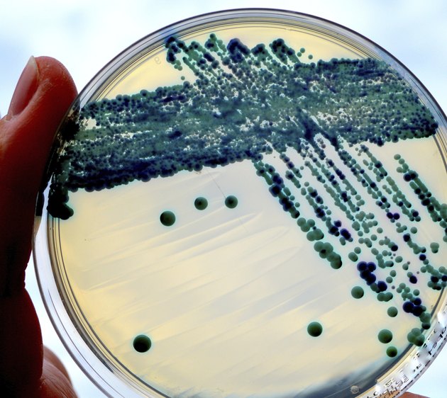 Yeast