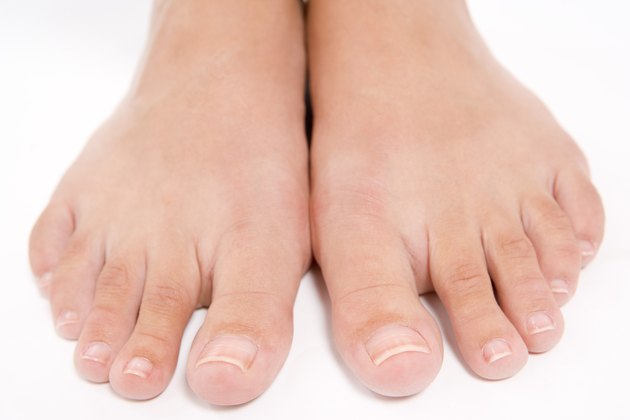 how-to-get-rid-of-thick-skin-under-the-toenails-livestrong