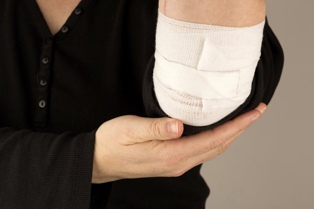 Injured arm
