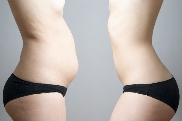 Obesity before after