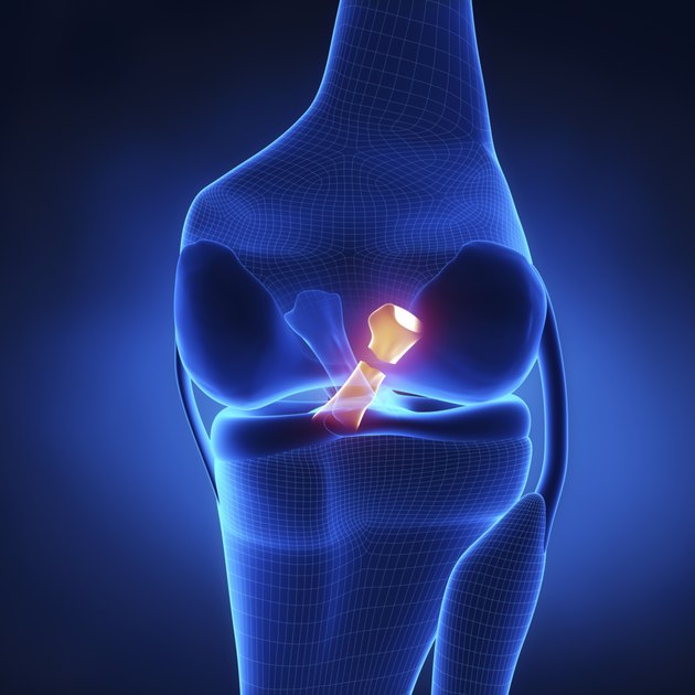 Torn Posterior Cruciate Ligament