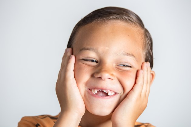 Boy showing missing teeth.