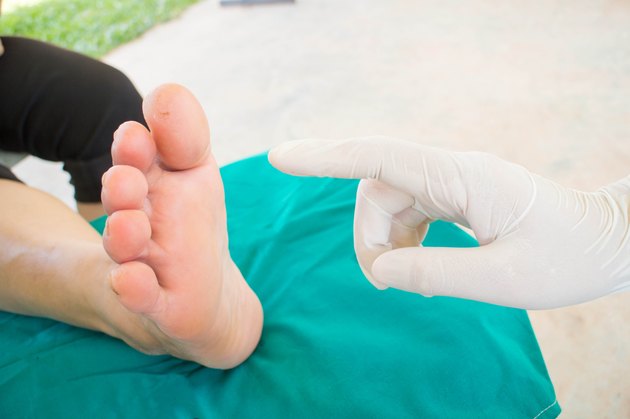 diabatic foot skining neuropathy