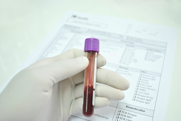 blood tube in hand of scientist