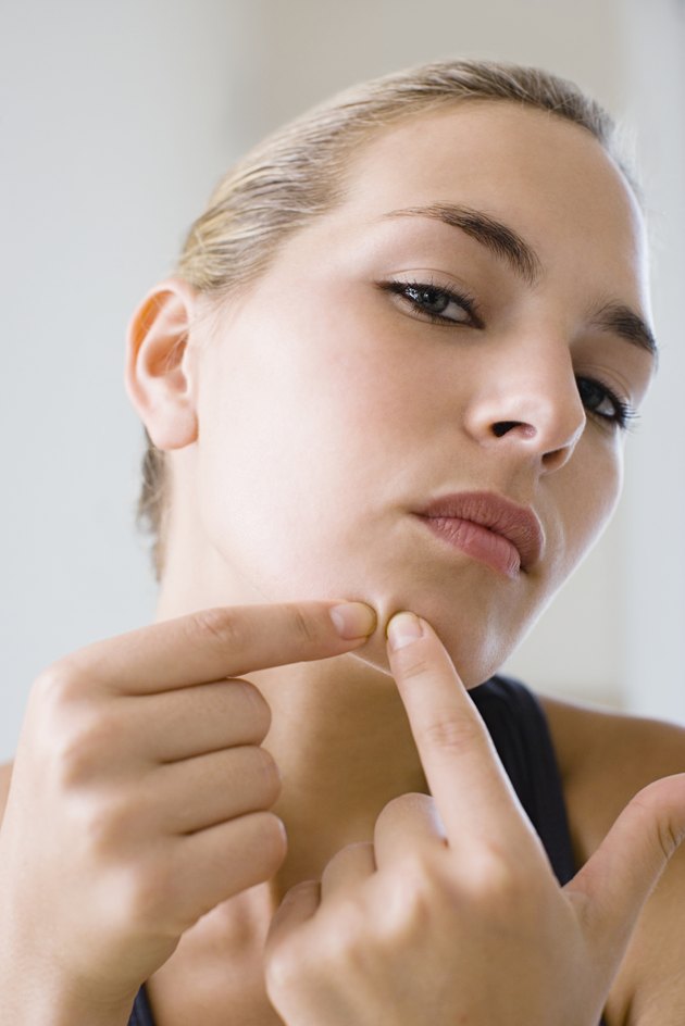 Woman squeezing spot