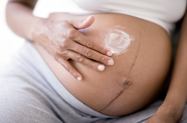 Pregnant woman applying cream to stretch marks