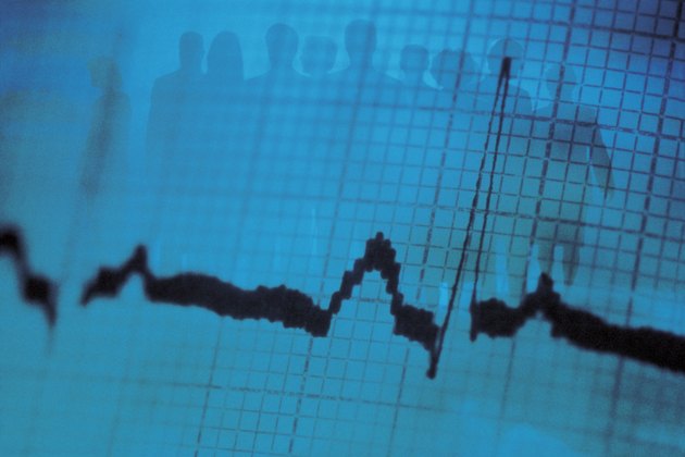 Silhouette of businesspeople on ekg printout with heartbeat
