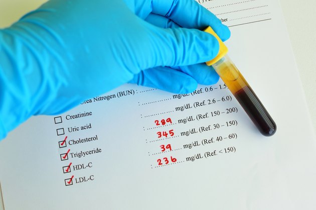 High lipid profile result