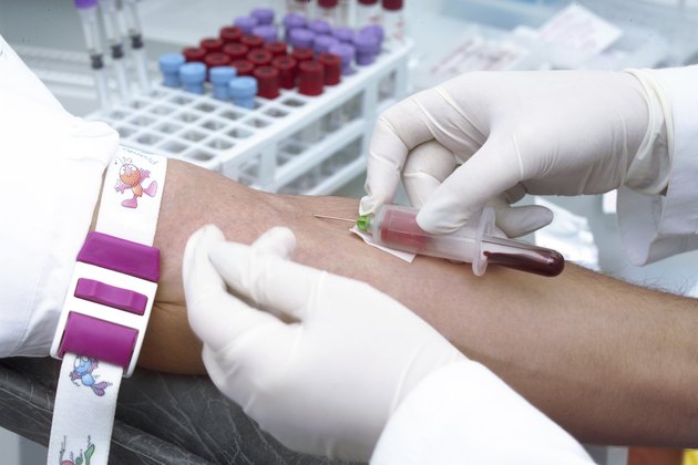 Doctor is taking blood for test.