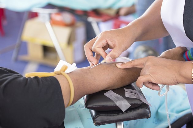 arm of a donor donating blood at hemotransfusion station