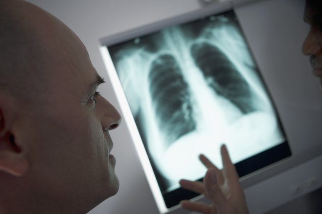 Male healthcare worker looking at x-ray, with person's hand on side of image