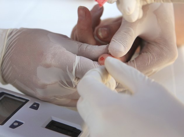 Cholesterol test