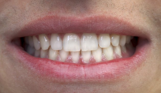 Mouth and teeth