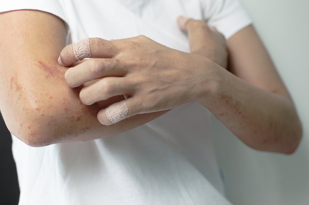 Itching caused by allergies, skin women.