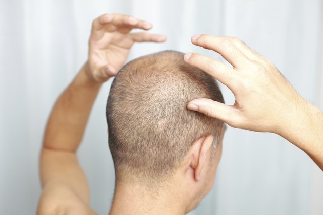 scalp massage