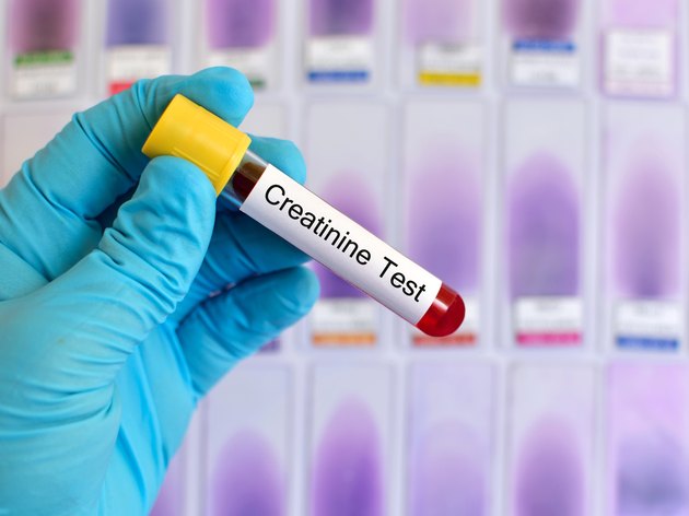 Normal Creatinine Levels in Urine | Livestrong.com