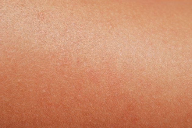 human skin