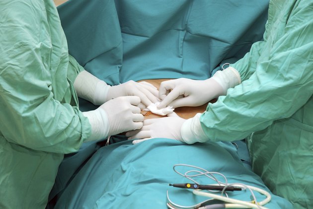 Surgery