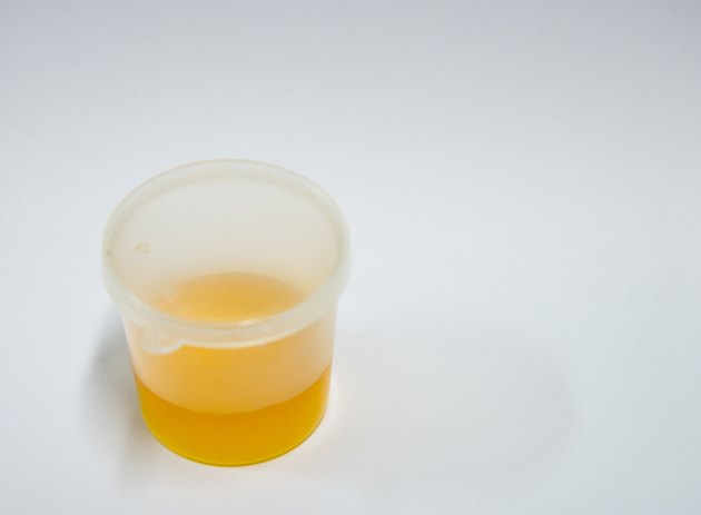 urine