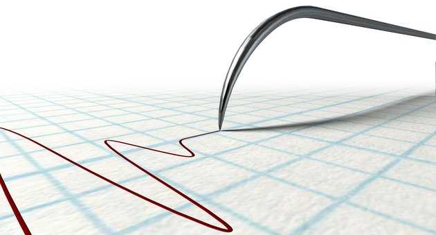 Polygraph Needle And Drawing