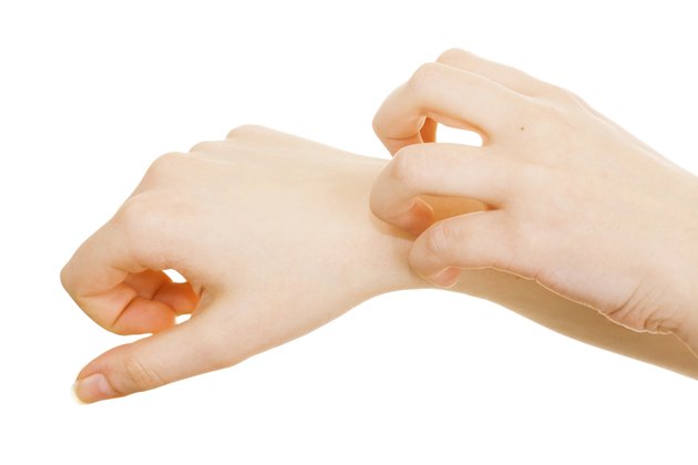 Itchiness