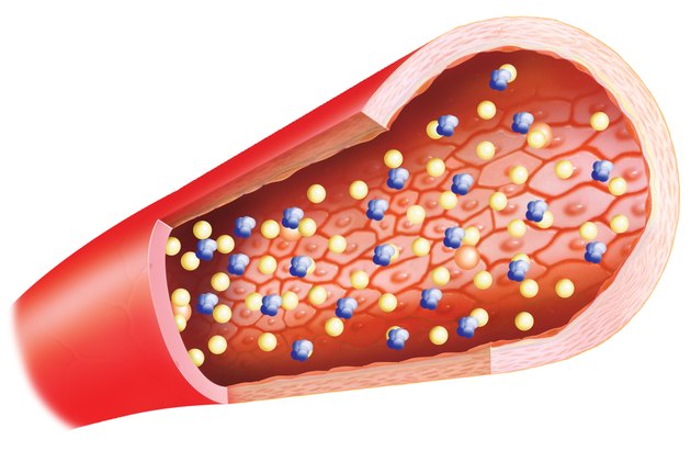 Hdl–Ldl