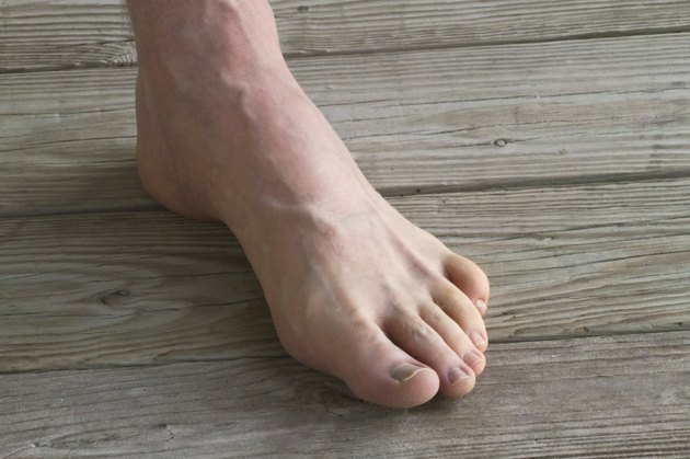 Male Foot With Prominant Veins