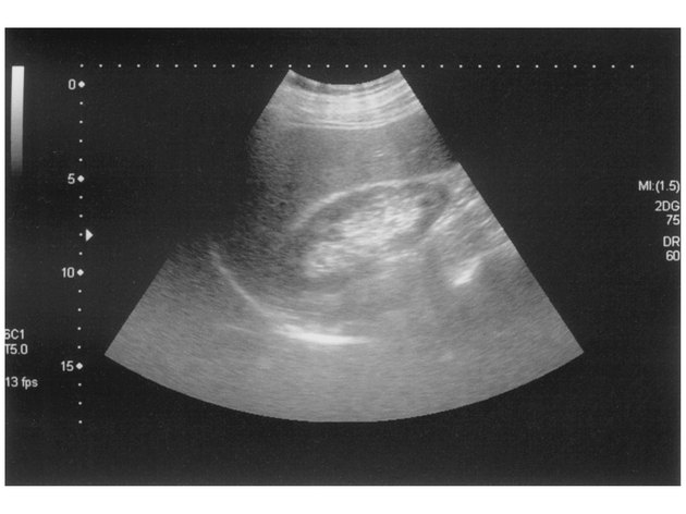 Ultrasound scan