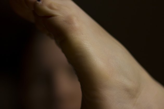 Arch of Foot