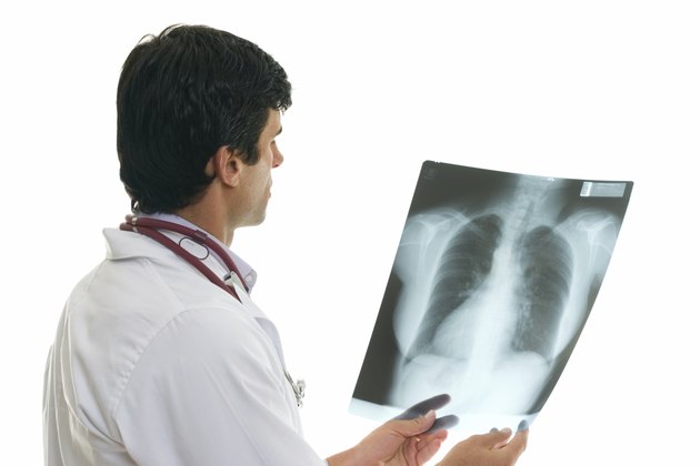 Oncologist with chest x-ray
