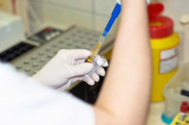 Blood test.