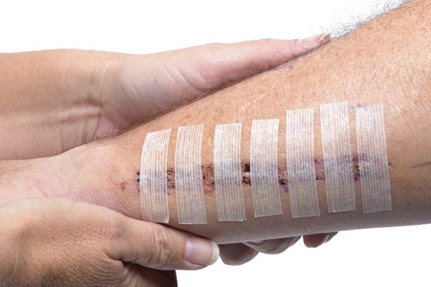 Medical Care