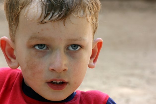 Litytle dirty face