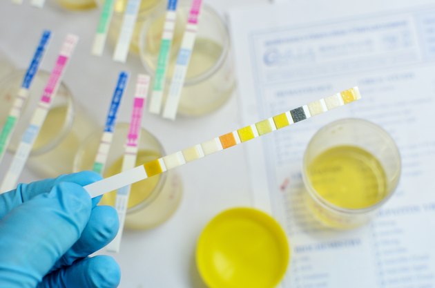 Urine analysis