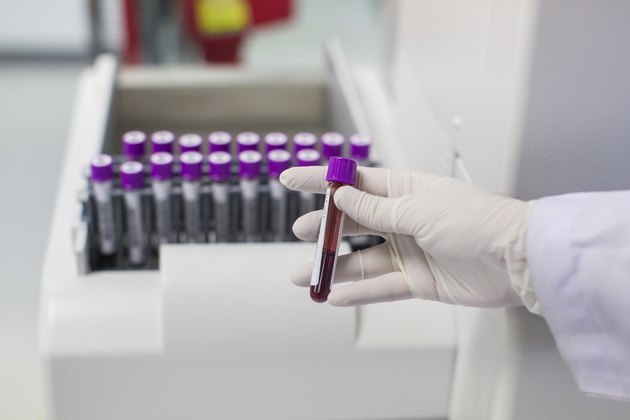 Blood tubes for complete blood count test