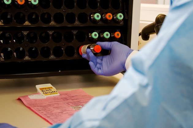 Blood culture incubation vials