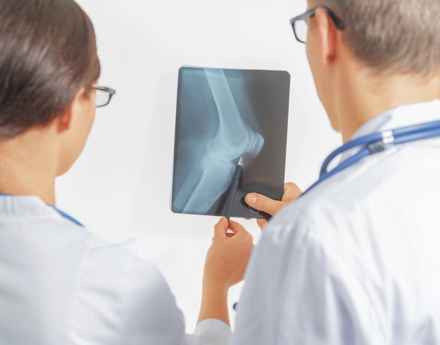 Two doctors look at x-ray image