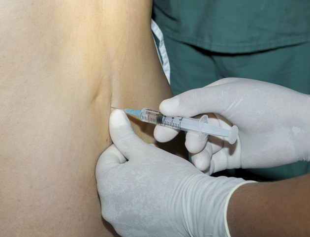 Spinal Anesthetic