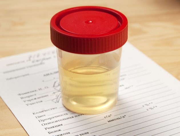 Urine analysis