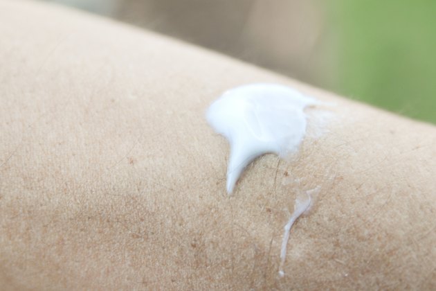 How to Remove Ingrown Arm Hair | Livestrong.com