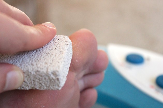 How to Get Rid of Dead Skin on Feet | Livestrong.com