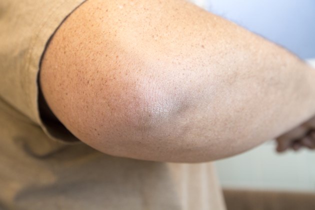 How To Get Rid Of Dark Rough Elbows