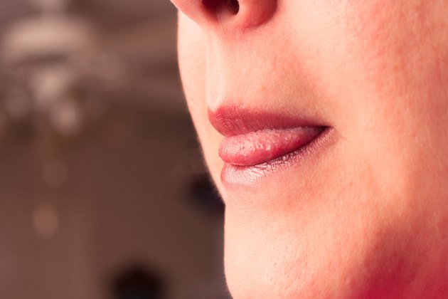 How To Repair Cracked Lips 