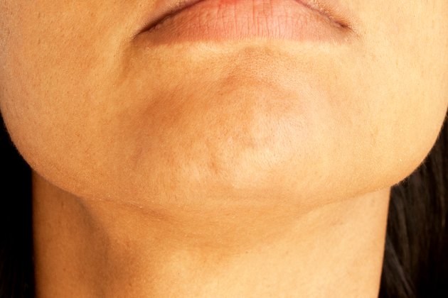 Treatment for Dry Skin on the Chin | Livestrong.com