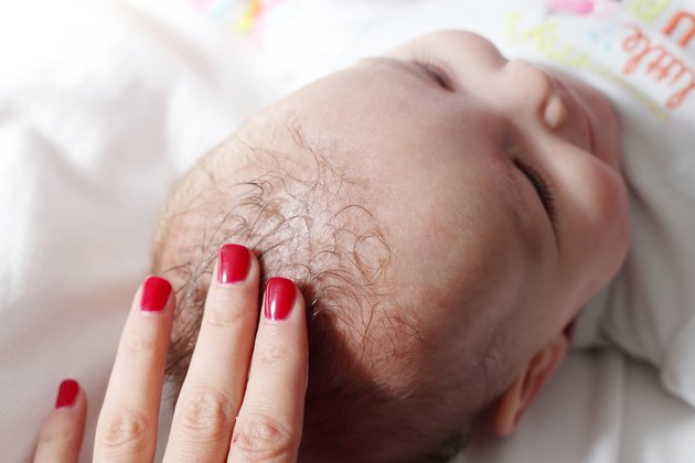 how-to-treat-dry-scalp-in-babies-livestrong