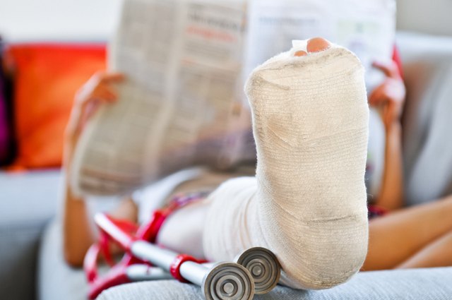 Treatment for a Broken Fibula | Livestrong.com