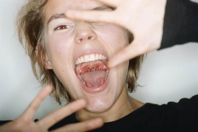 discolored-roof-of-mouth-r-askdentists