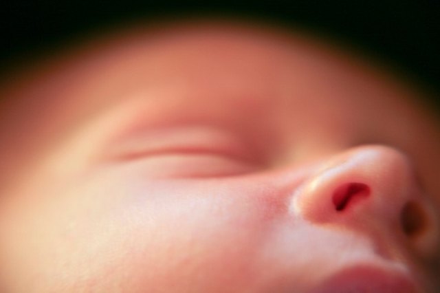 Baby Nose Not Development In The Womb