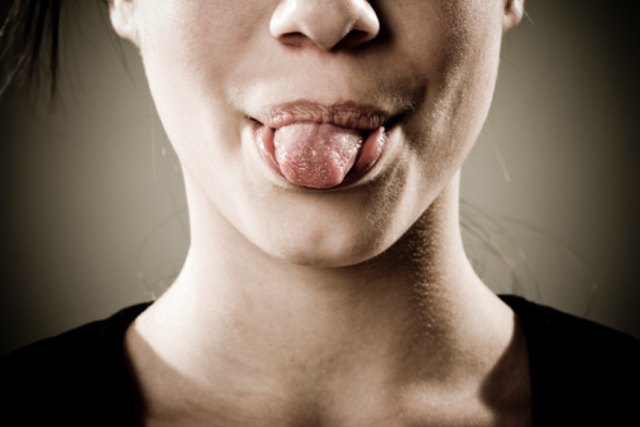 cracked-sore-tongue-livestrong